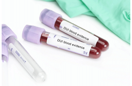 Why Refusing a DUI Blood Test is a Costly Mistake in California